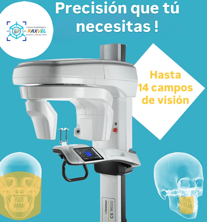 Radiografía