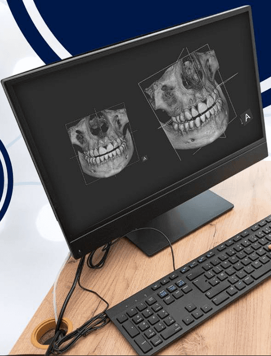 Radiografía